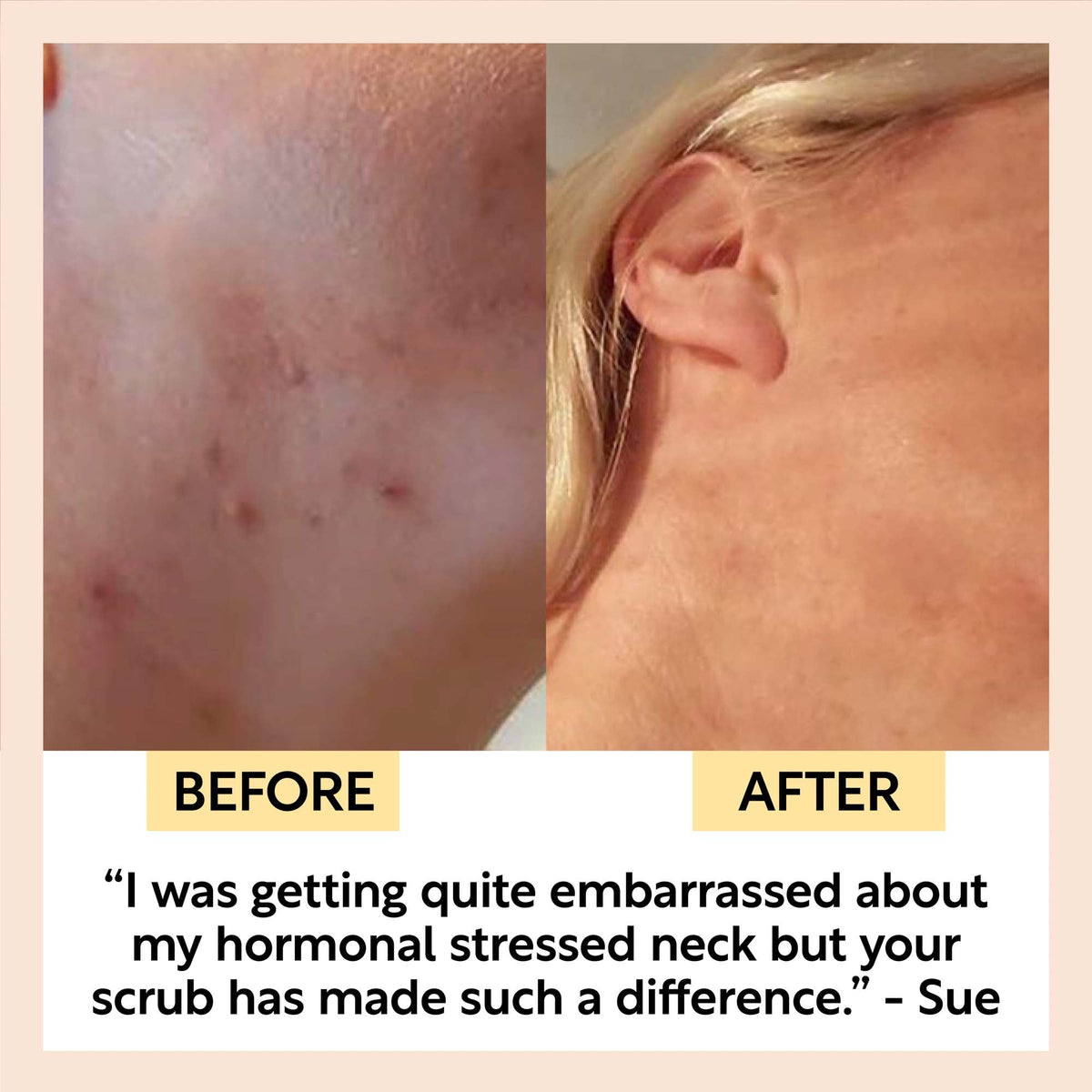 Face Scrub with Coffee + Rosehip Oil